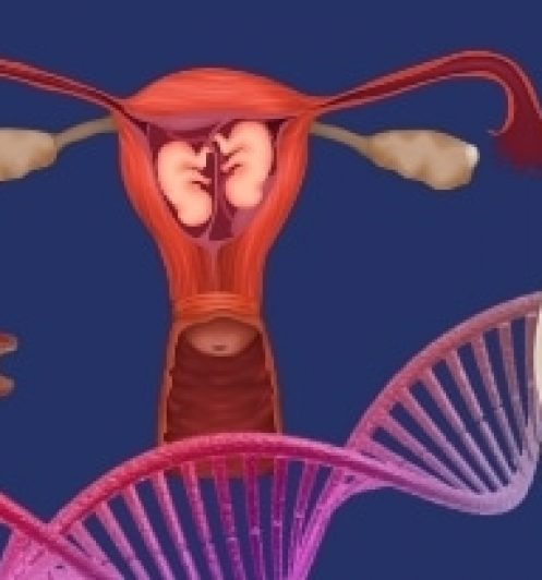 17 figura fundo azul ilustrando Ultrassom Transvaginal para Medida do Colo Uterino virtus ultrassonografia em blumenau